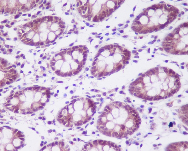 IHC - Anti-CKII alpha CSNK2A1 Rabbit Monoclonal Antibody ABO14023